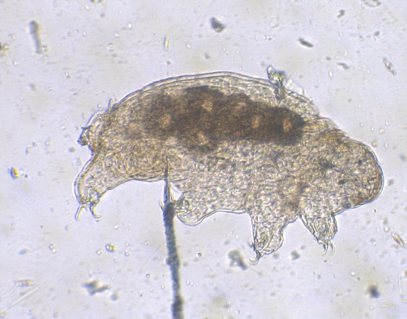 This tardigrade viewed with the aid of a microscope has visible eggs within its hemocoel or body cavity.
